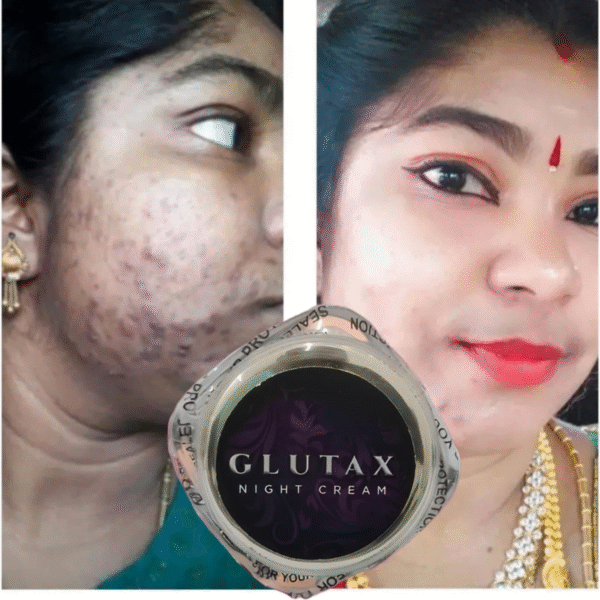Glutax Skin Whitening Cream For Men and Women - Image 4