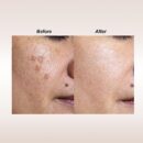Dalfour Beauty Vitamin C Serum + Chromabright - Most Advanced Skin Brighteners with Intensive Skin Repair